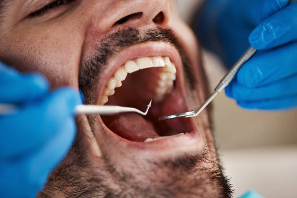 Best Emergency Dentist for Knocked-Out Tooth in Archbald, PA